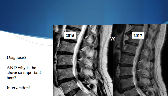 Spinal MRI Courses